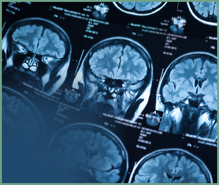 Catastrophic Injuries